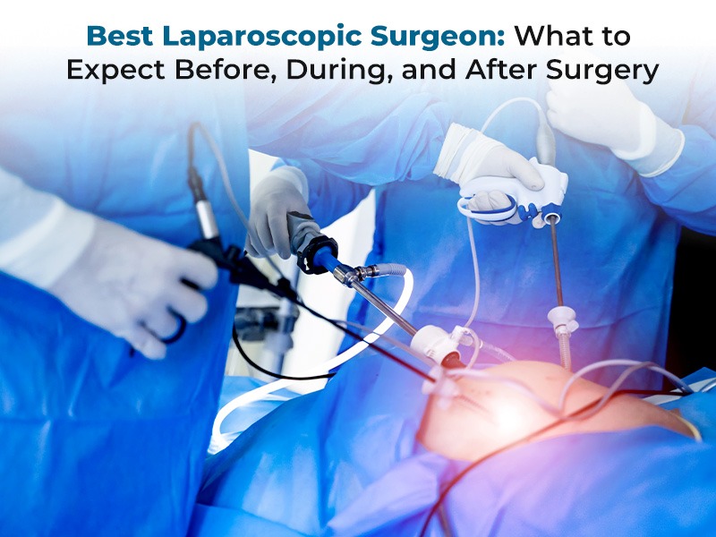 Best Laparoscopic Surgeon: What to Expect Before, During, and After Surgery